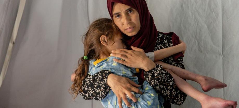 صحة غزة: حالتا وفاة بالمجاعة وسوء التغذية خلال الـ 24 ساعة الماضية  