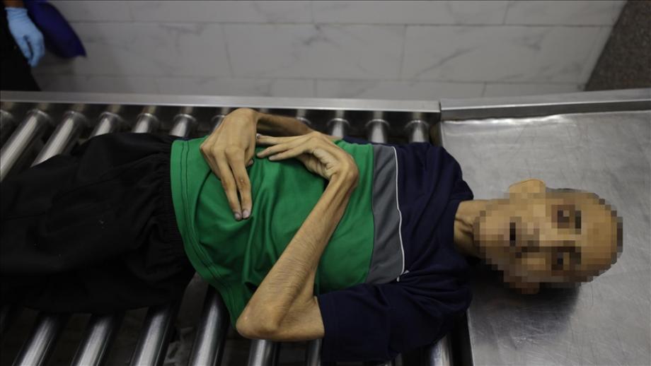 حمادة ورش الأغا ..  شابّ في مقتبل العمر يموت جوعًا في غزَّة