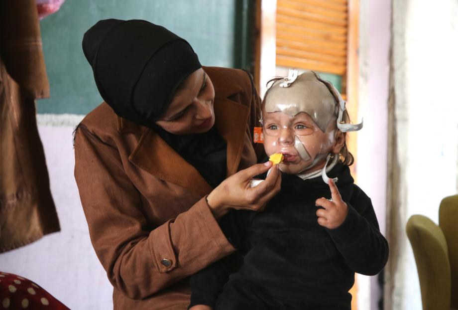 الطِّفل محمَّد حجيلة … نجا من القصف وبقي أسير الحروق 