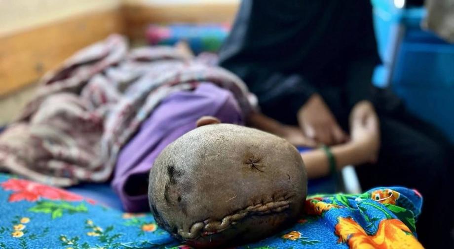  أسرة أبو عزوم ..  طفل يصارع الشَّلل وأب أقعدته الإصابة عن العمل