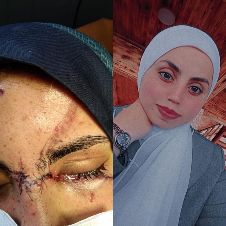 عيَّن حنين ..  شهادة حيَّة على وجع غزَّة الَّذي لا يمحى