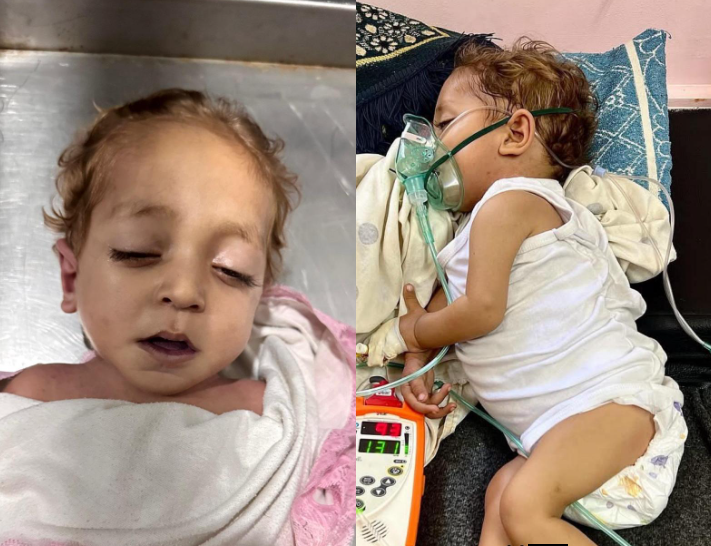 وفاة طفل من قطاع غزة نتيجة حرمانه من العلاج