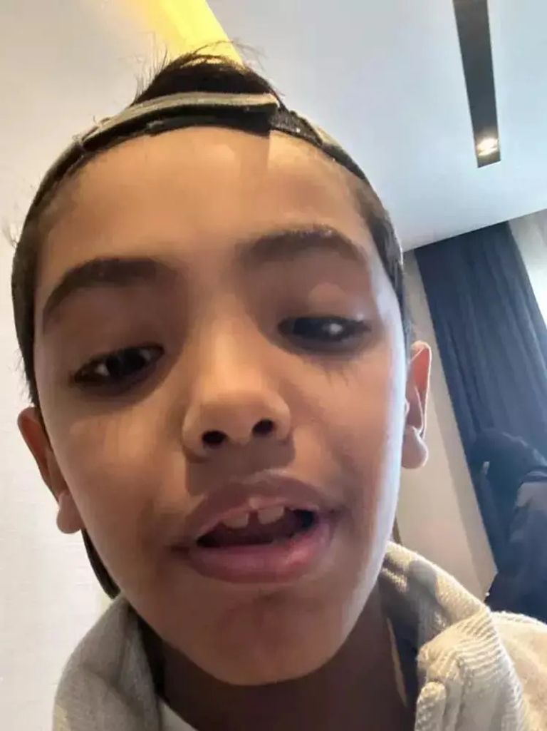 img13