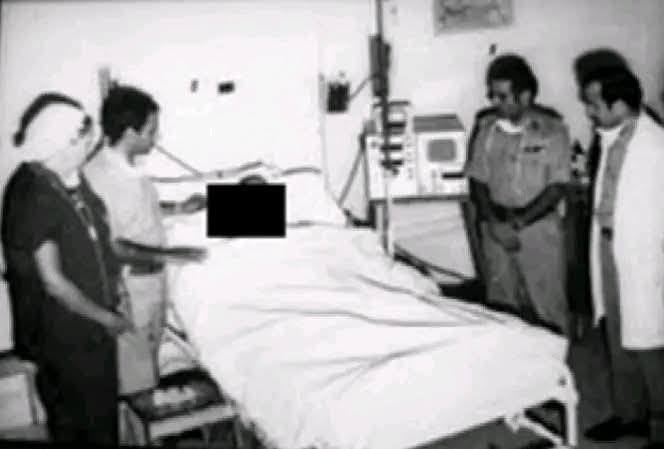 أول عملية لزراعة كلية في العالم العربي أُجريت في الأردن عام 1972